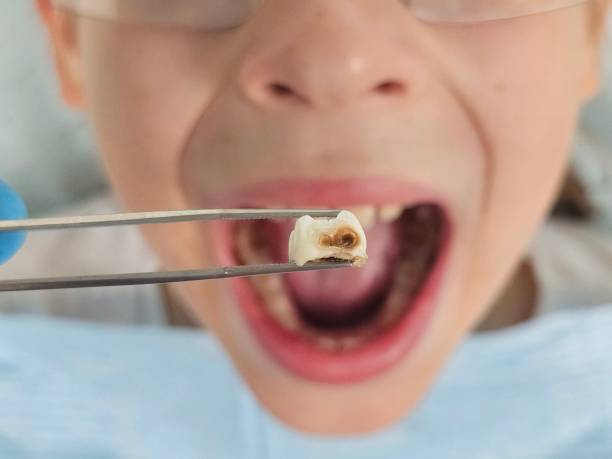 Best Emergency Dental Care for Trauma or Injury in Jerome, IL
